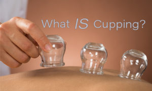 Featured image for cupping blog