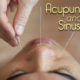 Acupuncture and Sinus Pain