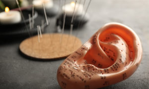 Image of a plastic ear with acupuncture needles
