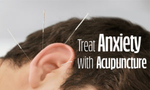 Image of a man's ear with acupuncture needles