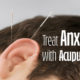 Image of a man's ear with acupuncture needles