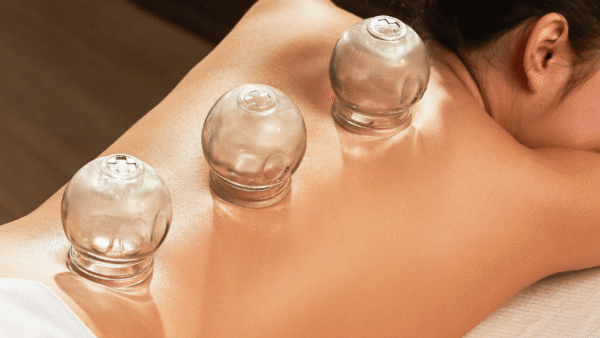 what is cupping