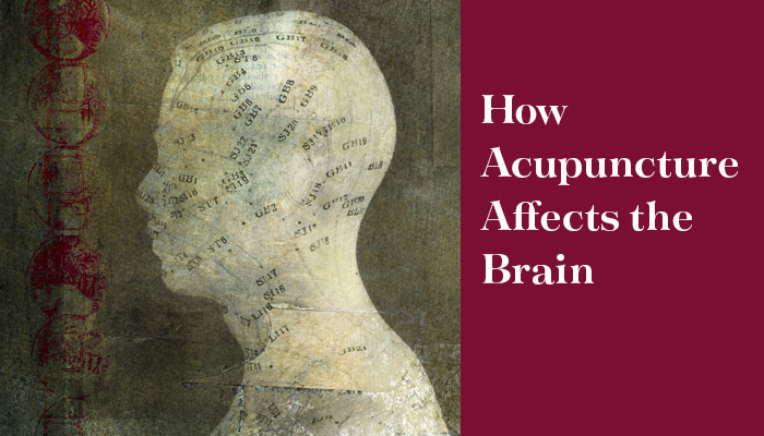How Acupuncture Affects the brain