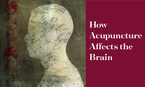 Header image with title How Acupuncture Affects the Brain