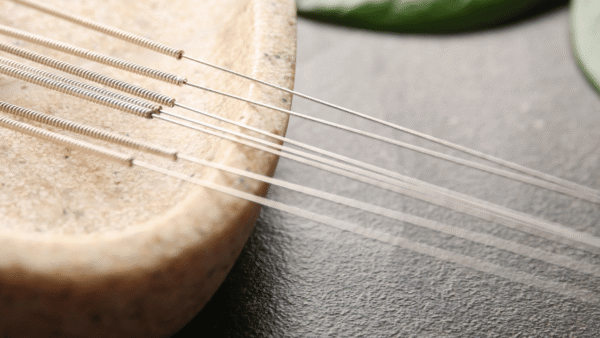 medical studies on acupuncture