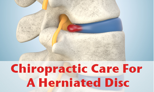 image of blog title "Chiropractic Care for a Herniated Disc"