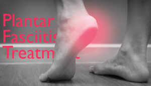 Main image of the blog "Plantar Fasciitis"