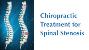 Chiropractic Treatment for Spinal Stenosis