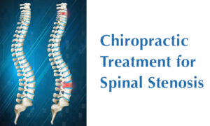 Main image for the blog Chiropractic Treatment for Spinal Stenosis