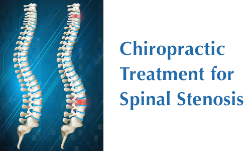 Main image for the blog Chiropractic Treatment for Spinal Stenosis